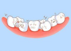 青上矫正齿科：儿童牙齿矫正，这三个黄金时期千万